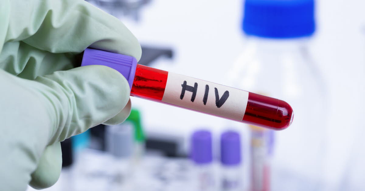 La lutte contre le VIH/Sida subit un revers historique, alerte la santé mondiale
