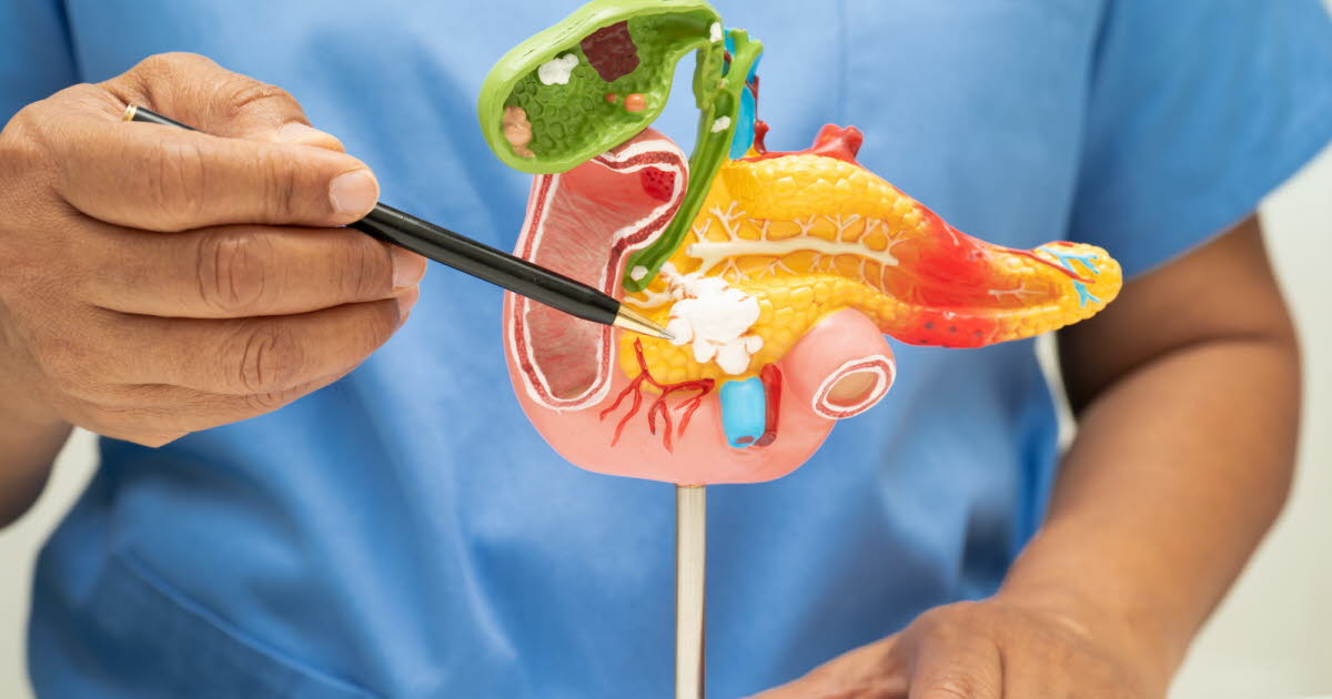 Des chercheurs éliminent le cancer du pancréas chez la souris