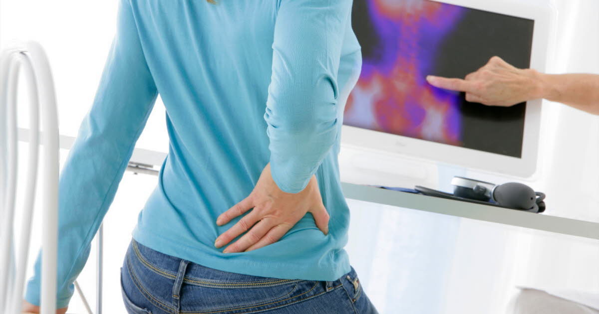 Qu’est-ce que le syndrome de la queue de cheval dont souffre Mimie Mathy ?